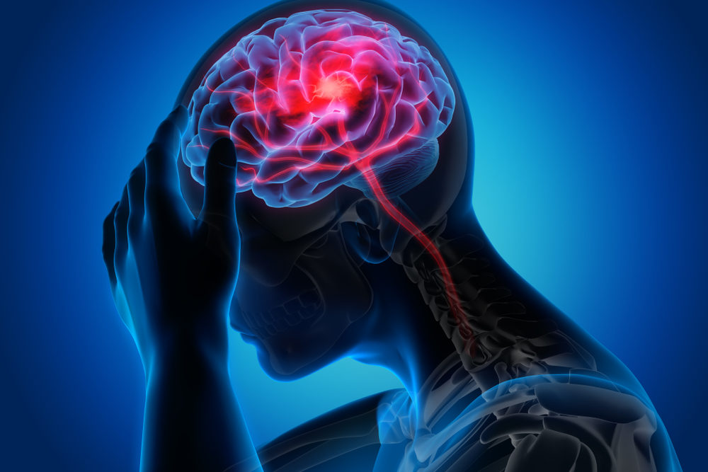 Traumatic Brain Injuries Often Require Lifelong Care 3D illustration of a man holding his head with brain showing headache