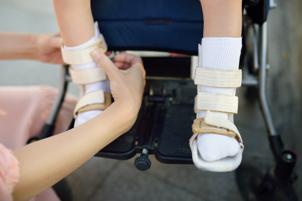 How Birth Injuries Cause Cerebral Palsy mother putting on her child with cerebral palsy's orthosis in wheelchair