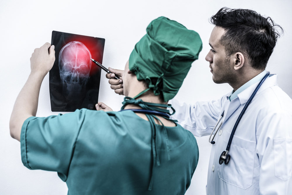 Concussion Symptoms Can Linger for a Year After Brain Injury Concussion Symptoms Can Linger for a Year After Brain Injury